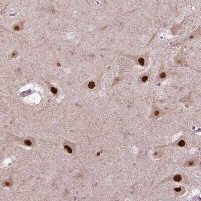 Immunohistochemistry-Paraffin: Proteasome 19S S7 Antibody [NBP2-56743] - Staining of human hippocampus shows strong nuclear positivity in neuronal cells.