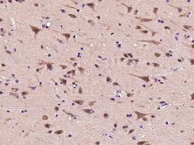 Immunohistochemistry-Paraffin: Proteasome 19S S7 Antibody [NBP2-99611] - Immunochemical staining of human Proteasome 19S S7 in human brain with rabbit polyclonal antibody at 1:300 dilution, formalin-fixed paraffin embedded sections.