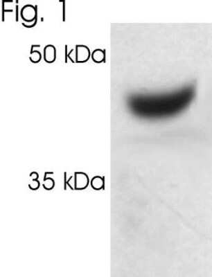 Western Blot: Proteasome 19S S7 Antibody [NB120-3322] - Analysis of proteasome 19S subunit S7 on HeLa cell lysate.