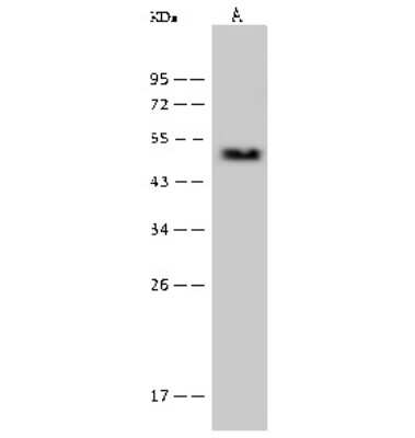 Western Blot: Proteasome 19S S7 Antibody [NBP2-99611] - Anti-Proteasome 19S S7 rabbit polyclonal antibody at 1:500 dilution. Lane A: Hela Whole Cell Lysate Lysates/proteins at 30 ug per lane. Secondary Goat Anti-Rabbit IgG (H+L)/HRP at 1/10000 dilution. Developed using the ECL technique. Performed under reducing conditions. Predicted band size: 49 kDa. Observed band size: 49 kDa