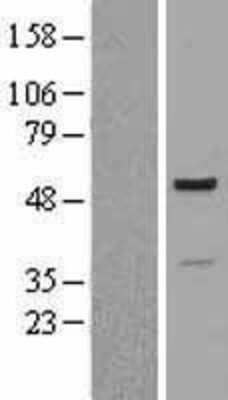 Western Blot: Proteasome 19S S7 Overexpression Lysate (Adult Normal) [NBL1-14887] Left-Empty vector transfected control cell lysate (HEK293 cell lysate); Right -Over-expression Lysate for Proteasome 19S S7.