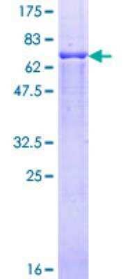 SDS-PAGE Recombinant Human Proteasome 19S S7 GST (N-Term) Protein