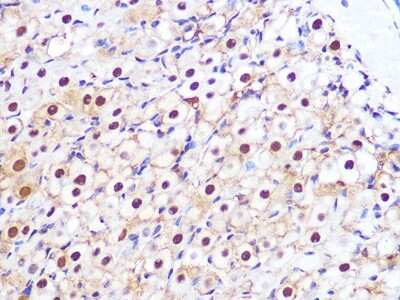 Immunohistochemistry-Paraffin: Proteasome 20S alpha 3 Antibody (7X8W9) [NBP3-16551] - Immunohistochemistry of paraffin-embedded rat ovary using Proteasome 20S alpha 3 Rabbit mAb (NBP3-16551) at dilution of 1:100 (40x lens).Perform microwave antigen retrieval with 10 mM PBS buffer pH 7.2 before commencing with IHC staining protocol.