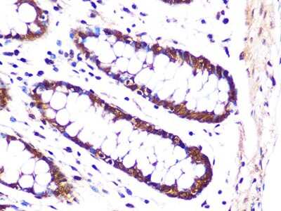 Immunohistochemistry-Paraffin: Proteasome 20S alpha 3 Antibody (7X8W9) [NBP3-16551] - Immunohistochemistry of paraffin-embedded human colon using Proteasome 20S alpha 3 Rabbit mAb (NBP3-16551) at dilution of 1:100 (40x lens).Perform microwave antigen retrieval with 10 mM PBS buffer pH 7.2 before commencing with IHC staining protocol.