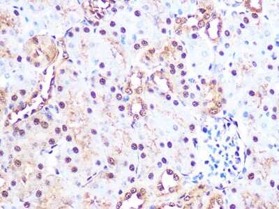 Immunohistochemistry-Paraffin: Proteasome 20S alpha 3 Antibody (7X8W9) [NBP3-16551] - Immunohistochemistry of paraffin-embedded mouse kidney using Proteasome 20S alpha 3 Rabbit mAb (NBP3-16551) at dilution of 1:100 (40x lens).Perform microwave antigen retrieval with 10 mM PBS buffer pH 7.2 before commencing with IHC staining protocol.