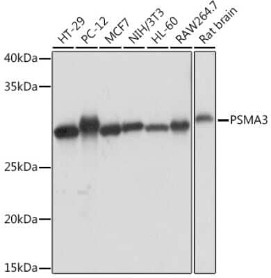 Western Blot: Proteasome 20S alpha 3 Antibody (7X8W9) [NBP3-16551] - Western blot analysis of extracts of various cell lines, using Proteasome 20S alpha 3 Rabbit mAb (NBP3-16551) at 1:1000 dilution. Secondary antibody: HRP Goat Anti-Rabbit IgG (H+L) at 1:10000 dilution. Lysates/proteins: 25ug per lane. Blocking buffer: 3% nonfat dry milk in TBST. Detection: ECL Basic Kit. Exposure time: 1s.