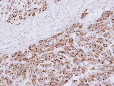 Immunohistochemistry-Paraffin: Proteasome 20S alpha 3 Antibody [NBP1-33537] - Paraffin-embedded U87 xenograft, using antibody at 1:100 dilution.