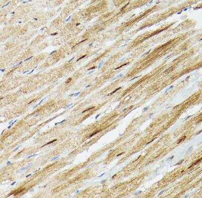 Immunohistochemistry-Paraffin: Proteasome 20S alpha 3 Antibody [NBP2-94032] - Mouse heart using PSMA3 Rabbit pAb at dilution of 1:100 (40x lens).