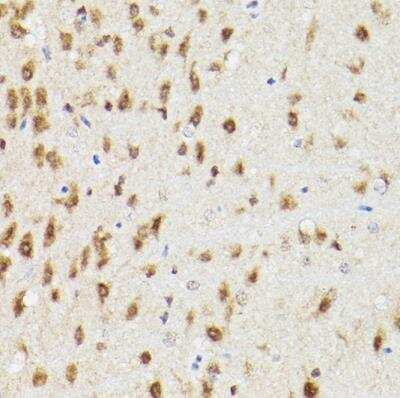 Immunohistochemistry-Paraffin: Proteasome 20S alpha 3 Antibody [NBP2-94032] - Rat brain using PSMA3 Rabbit pAb at dilution of 1:100 (40x lens).