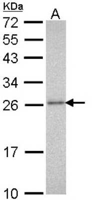 Western Blot: Proteasome 20S alpha 3 Antibody [NBP1-33537] - Sample (30 ug of whole cell lysate) A: Molt-4 12% SDS PAGE; antibody diluted at 1:1000.