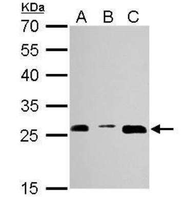 Western Blot: Proteasome 20S alpha 3 Antibody [NBP1-33537] - A. 30 ug NIH-3T3 whole cell lysate/extract  B. 30 ug JC whole cell lysate/extract C. 30 ug BCL-1 whole cell lysate/extract  12 % SDS-PAGE Proteasome 20S alpha 3 antibody dilution: 1:1000