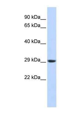 Western Blot: Proteasome 20S alpha 3 Antibody [NBP1-54374] - Titration: 0.2-1 ug/ml, Positive Control: Human brain.