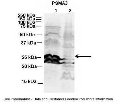 Western Blot: Proteasome 20S alpha 3 Antibody [NBP1-54374] - Titration: 2 ug/ml Positive Control: Human NT-2 cells and Mouse WT brain.