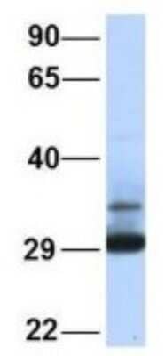 Western Blot: Proteasome 20S alpha 3 Antibody [NBP1-54374] - Human 721_B, Antibody Dilution: 1.0 ug/ml PSMA3 is supported by BioGPS gene expression data to be expressed in 721_B.