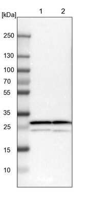 Western Blot: Proteasome 20S alpha 3 Antibody [NBP1-92293] - Lane 1: NIH-3T3 cell lysate (Mouse embryonic fibroblast cells). Lane 2: NBT-II cell lysate (Rat Wistar bladder tumor cells).