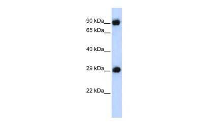 Western Blot: Proteasome 20S alpha 3 Antibody [NBP2-88094] - WB Suggested Anti-PSMA3 Antibody Titration: 0.2-1 ug/ml. ELISA Titer: 1:312500. Positive Control: 293T cell lysate