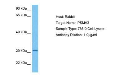 Western Blot: Proteasome 20S alpha 3 Antibody [NBP2-88095] - Host: Rabbit. Target Name: PSMA3. Sample Tissue: Human 786-0 Whole Cell lysates. Antibody Dilution: 1ug/ml