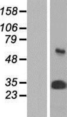 Western Blot: Proteasome 20S alpha 3 Overexpression Lysate (Adult Normal) [NBP2-10848] Left-Empty vector transfected control cell lysate (HEK293 cell lysate); Right -Over-expression Lysate for Proteasome 20S alpha 3.