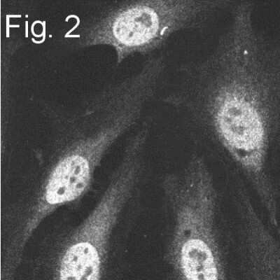 Immunocytochemistry/Immunofluorescence: Proteasome 20S alpha 5 Antibody [NB120-11437] - HeLa cells