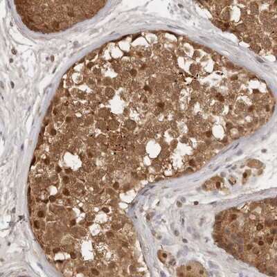 Immunohistochemistry-Paraffin: Proteasome 20S alpha 5 Antibody [NBP1-86838] - Staining of human testis shows distinct nuclear and cytoplasmic positivity in seminiferous duct cells.