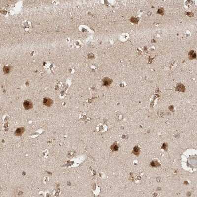 Immunohistochemistry-Paraffin: Proteasome 20S alpha 5 Antibody [NBP1-86839] - Staining of human cerebral cortex shows strong cytoplasmic and nuclear positivity in neuronal cells.