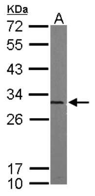 Western Blot: Proteasome 20S alpha 5 Antibody [NBP1-32387] - Sample (50 ug of whole cell lysate) A: mouse brain 12% SDS PAGE; antibody diluted at 1:5000.