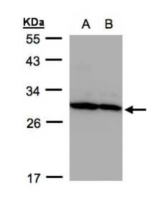 Western Blot: Proteasome 20S alpha 5 Antibody [NBP1-32387] - Sample(30 ug whole cell lysate)A: HeLa S3 12% SDS PAGE, antibody diluted at 1:500.