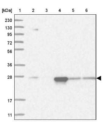 Western Blot: Proteasome 20S alpha 5 Antibody [NBP1-86837] - Lane 1: Marker  [kDa] 230, 130, 95, 72, 56, 36, 28, 17, 11.  Lane 2: Human cell line RT-4.  Lane 3: Human cell line U-251MG sp.  Lane 4: Human plasma (IgG/HSA depleted).  Lane 5: Human liver tissue.  Lane 6: Human tonsil tissue