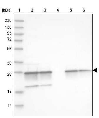 Western Blot: Proteasome 20S alpha 5 Antibody [NBP1-86838] - Lane 1: Marker  [kDa] 230, 130, 95, 72, 56, 36, 28, 17, 11.  Lane 2: Human cell line RT-4.  Lane 3: Human cell line U-251MG sp.  Lane 4: Human plasma (IgG/HSA depleted).  Lane 5: Human liver tissue.  Lane 6: Human tonsil tissue