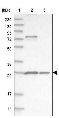 Western Blot: Proteasome 20S alpha 5 Antibody [NBP1-86839] - Lane 1: Marker  [kDa] 230, 130, 95, 72, 56, 36, 28, 17, 11.  Lane 2: Human cell line RT-4.  Lane 3: Human cell line U-251MG sp