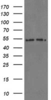 Western Blot: Proteasome 20S alpha 6 Antibody (OTI3B8) - Azide and BSA Free [NBP2-73642] - Analysis of HEK293T cells were transfected with the pCMV6-ENTRY control (Left lane) or pCMV6-ENTRY PSMA6.