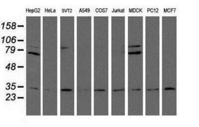 Western Blot: Proteasome 20S alpha 6 Antibody (OTI4C9) - Azide and BSA Free [NBP2-73637] - Analysis of extracts (35ug) from 9 different cell lines by using g anti-Proteasome 20S alpha 6 monoclonal antibody (HepG2: human; HeLa: human; SVT2: mouse; A549: human; COS7: monkey; Jurkat: human; MDCK: canine; PC12: rat; MCF7: human).