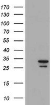 Western Blot: Proteasome 20S alpha 6 Antibody (OTI4C9) - Azide and BSA Free [NBP2-73637] - HEK293T cells were transfected with the pCMV6-ENTRY control (Left lane) or pCMV6-ENTRY Proteasome 20S alpha 6 (Right lane) cDNA for 48 hrs and lysed. Equivalent amounts of cell lysates (5 ug per lane) were separated by SDS-PAGE and immunoblotted with anti