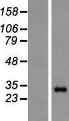 Western Blot Proteasome 20S alpha 6 Overexpression Lysate