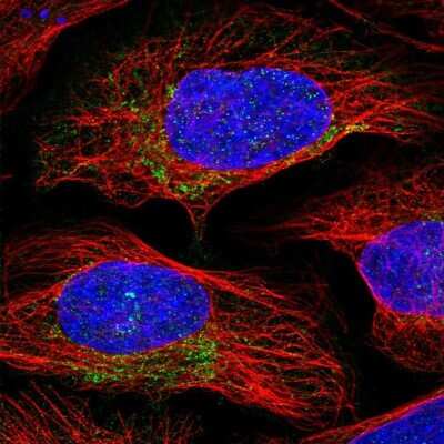 Immunocytochemistry/ Immunofluorescence Proteasome 20S beta 3 Antibody