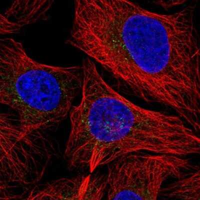 Immunocytochemistry/Immunofluorescence: Proteasome 20S beta 3 Antibody [NBP2-33516] - Staining of human cell line U-2 OS shows localization to mitochondria.