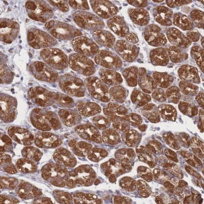 Immunohistochemistry-Paraffin: Proteasome 20S beta 3 Antibody [NBP2-33516] - Staining of human stomach, lower shows strong cytoplasmic positivity in glandular cells.