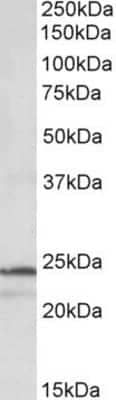 Western Blot: Proteasome 20S beta 3 Antibody [NBP1-52079] - (1ug/ml) staining of K562 lysate (35ug protein in RIPA buffer). Primary incubation was 1 hour. Detected by chemiluminescence.