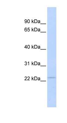 Western Blot: Proteasome 20S beta 3 Antibody [NBP1-54591] - Human Muscle lysate, concentration 0.2-1 ug/ml.