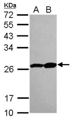 Western Blot: Proteasome 20S beta 3 Antibody [NBP2-19953] - Sample (30 ug of whole cell lysate) A: IMR32 B: U87-MG 12% SDS PAGE gel, diluted at 1:5000.