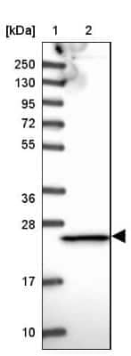 Western Blot Proteasome 20S beta 3 Antibody