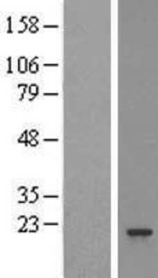 Western Blot: Proteasome 20S beta 3 Overexpression Lysate (Adult Normal) [NBL1-14878] Left-Empty vector transfected control cell lysate (HEK293 cell lysate); Right -Over-expression Lysate for Proteasome 20S beta 3.