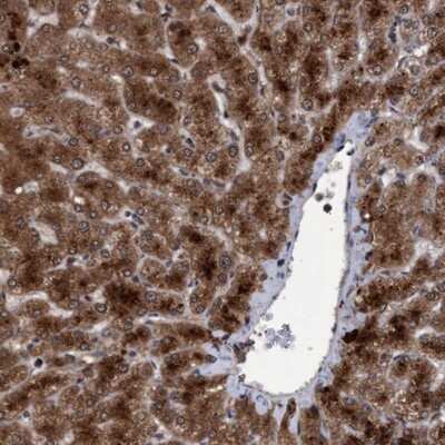 Immunohistochemistry-Paraffin: Proteasome 20S beta 6 Antibody [NBP1-88024] - Staining of human liver shows strong cytoplasmic positivity in hepatocytes.