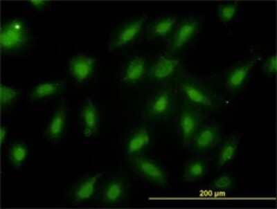 Immunocytochemistry/Immunofluorescence: Proteasome 20S beta 6 Antibody (S51) [H00005694-M02] - Analysis of monoclonal antibody to PSMB6 on HeLa cell. Antibody concentration 10 ug/ml.