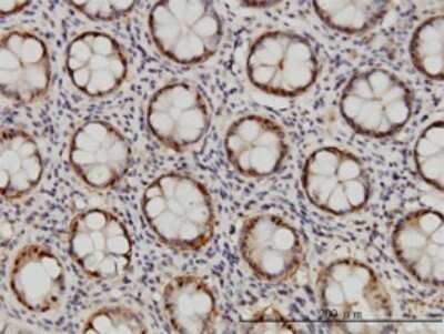 Immunohistochemistry-Paraffin: Proteasome 20S beta 6 Antibody (S51) [H00005694-M02] - Analysis of monoclonal antibody to PSMB6 on formalin-fixed paraffin-embedded human colon. Antibody concentration 1 ug/ml.