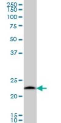 Western Blot Proteasome 20S beta 6 Antibody (S51)