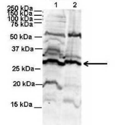 Western Blot: Proteasome 20S beta 6 Antibody [NBP1-56575] - Human NT-2 cells and Mouse WT brain, concentration 2ug/ml.