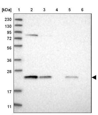 Western Blot: Proteasome 20S beta 6 Antibody [NBP1-88024] - Lane 1: Marker  [kDa] 230, 130, 95, 72, 56, 36, 28, 17, 11.  Lane 2: Human cell line RT-4.  Lane 3: Human cell line U-251MG sp.  Lane 4: Human plasma (IgG/HSA depleted).  Lane 5: Human liver tissue.  Lane 6: Human tonsil tissue