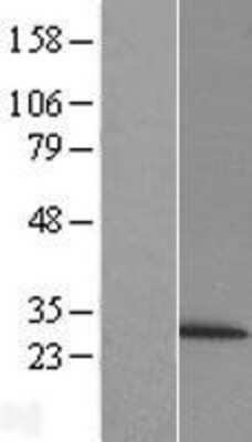 Western Blot: Proteasome 20S beta 6 Overexpression Lysate (Adult Normal) [NBL1-14881] Left-Empty vector transfected control cell lysate (HEK293 cell lysate); Right -Over-expression Lysate for Proteasome 20S beta 6.