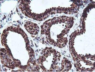 Immunohistochemistry-Paraffin: PSMB7 Antibody (OTI1E1) [NBP2-01832] - Staining of paraffin-embedded Human breast tissue using anti-Proteasome 20S beta 7 mouse monoclonal antibody.